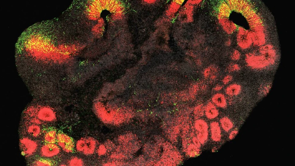 Cercetătorii au descoperit gena căreia îi datorăm creierul nostru mare