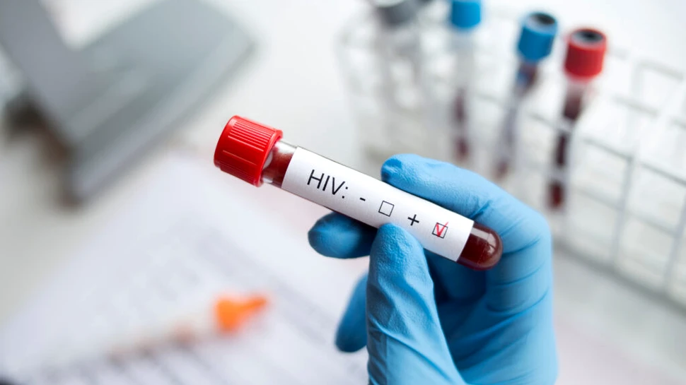 Infecția cu HIV lasă în urmă o „memorie imunologică” în celule