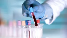 Un nou test de sânge poate depista cancerul cu trei ani înainte de diagnostic