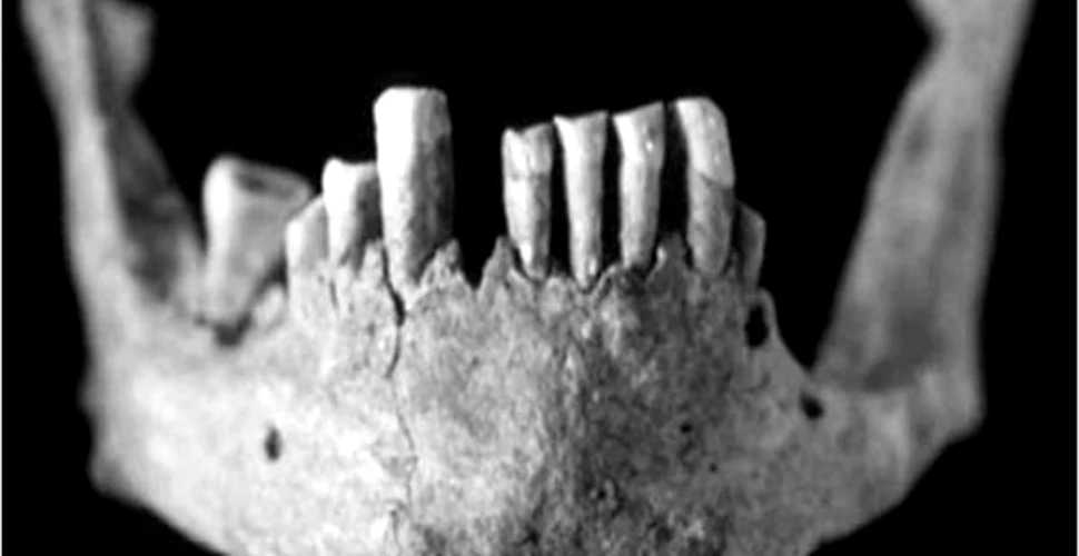 Un schelet vechi de patru milenii, prima evidenta a leprei