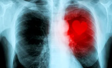 Boala cronică de rinichi otrăvește inimile pacienților, au descoperit oamenii de știință