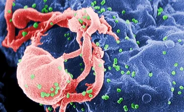 O boală enigmatică, ce aminteşte de SIDA, produce confuzie printre medici