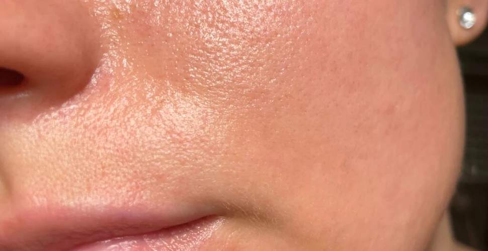 Îngrijirea pielii, între mit și știință: Ce spun dermatologii despre cele mai frecvente greșeli