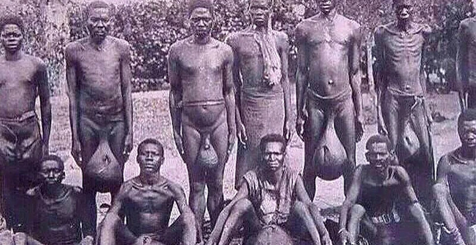 Ritualul SINISTRU al unui trib din Africa. În urma lui, testiculele bărbaţilor ajung la 80 de centimetri – FOTO+VIDEO