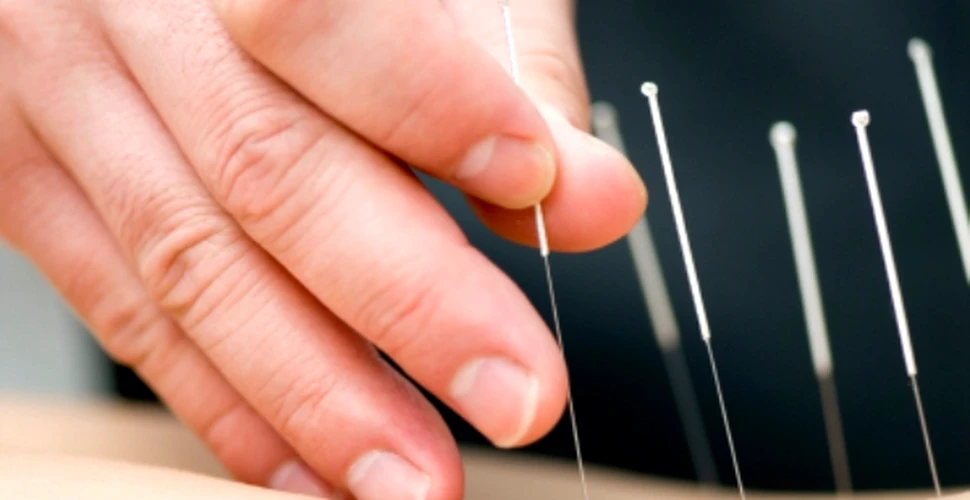 Acupunctura poate vindeca teama de dentist
