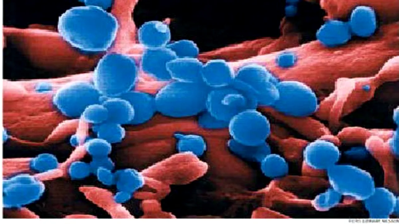 1-virus-sanatate 