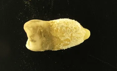 Bacteria scarlatinei a fost găsită într-o mumie precolumbiană. De ce contează descoperirea?
