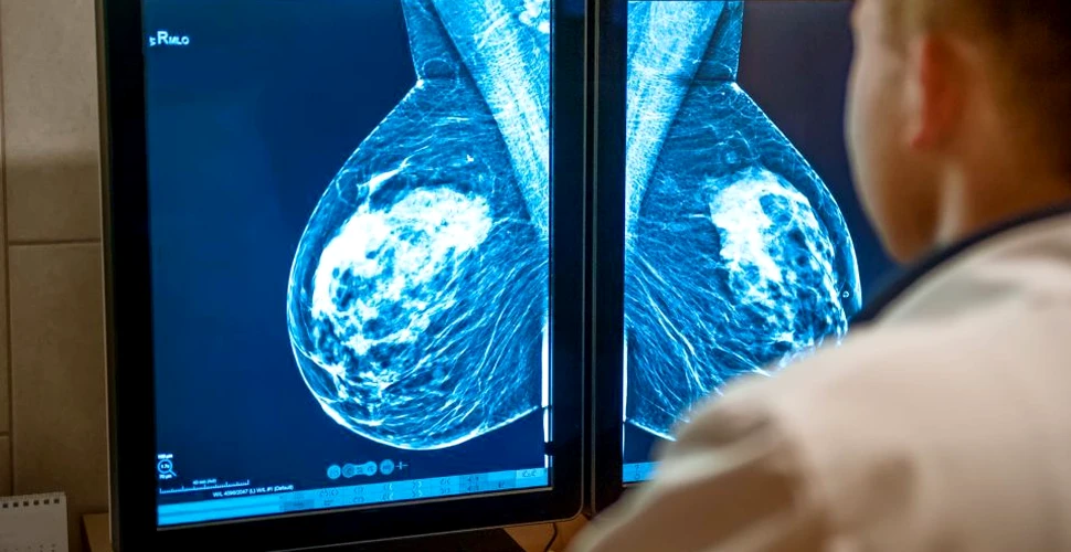 Un studiu pe animale a identificat o proteină care duce la metastaza cancerului de sân
