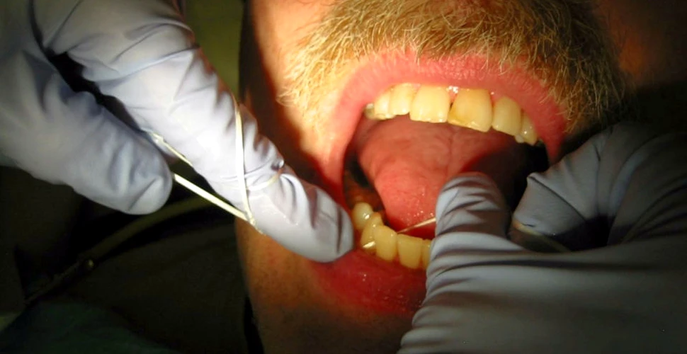 Unul dintre marile mituri a fost demontat! Beneficiile utilizării aţei dentare, promovate intens, nu au fost dovedite ştiinţific