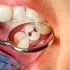 Mai bine de jumătate dintre copii și adulții din România au carii dentare