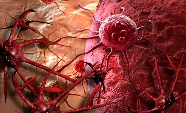 O metodă ingenioasă de combatere a cancerului: „înfometarea” celulelor canceroase prin eliminarea cuprului din organism