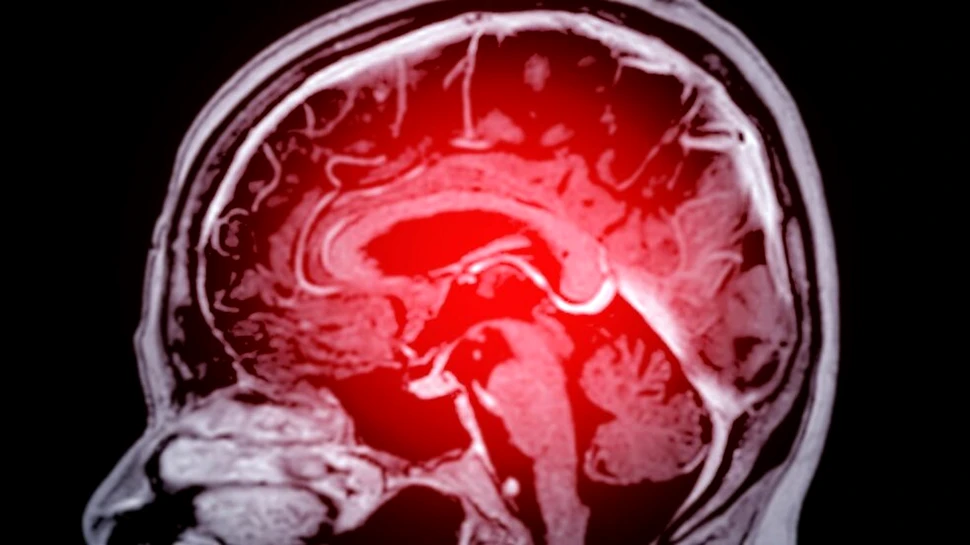 Vârsta la care creierul începe să îmbătrânească mai repede