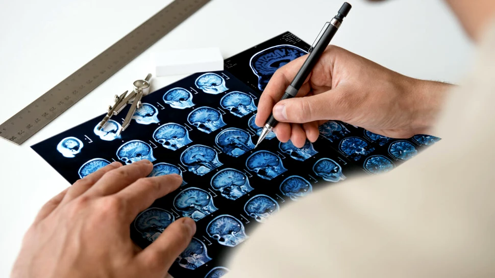 Creierul persoanelor care consumă cocaină îmbătrânește mai rapid