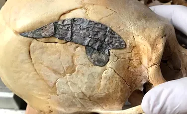 Un craniu cu un implant metalic, una dintre cele mai vechi dovezi ale unui implant chirurgical antic