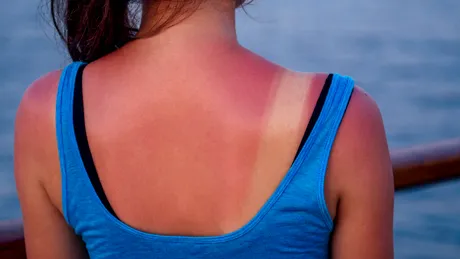 Ce înseamnă SPF, ce este radiația UV și cât de eficiente sunt cremele cu protecție solară