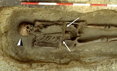 Un italian medieval și-a înlocuit mâna amputată cu un cuțit. Descoperirea făcută de arheologi