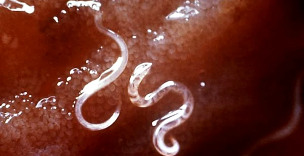 Viermii paraziti – un posibil tratament pentru scleroza multipla?
