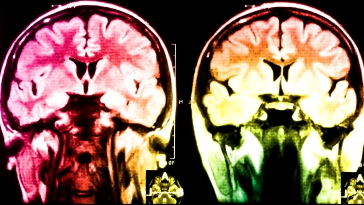 1-12689422-ml 