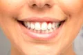 Sângerarea gingiilor ar putea fi un semn precoce al unei afecțiuni mult mai grave