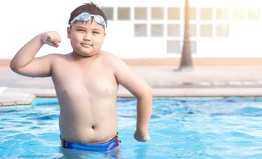 Sindromul Prader Willi, boala genetică ce reprezintă una dintre cauzele obezităţii la copii