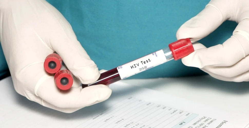 Un vaccin experimental anti-HIV a generat rezultate promiţătoare