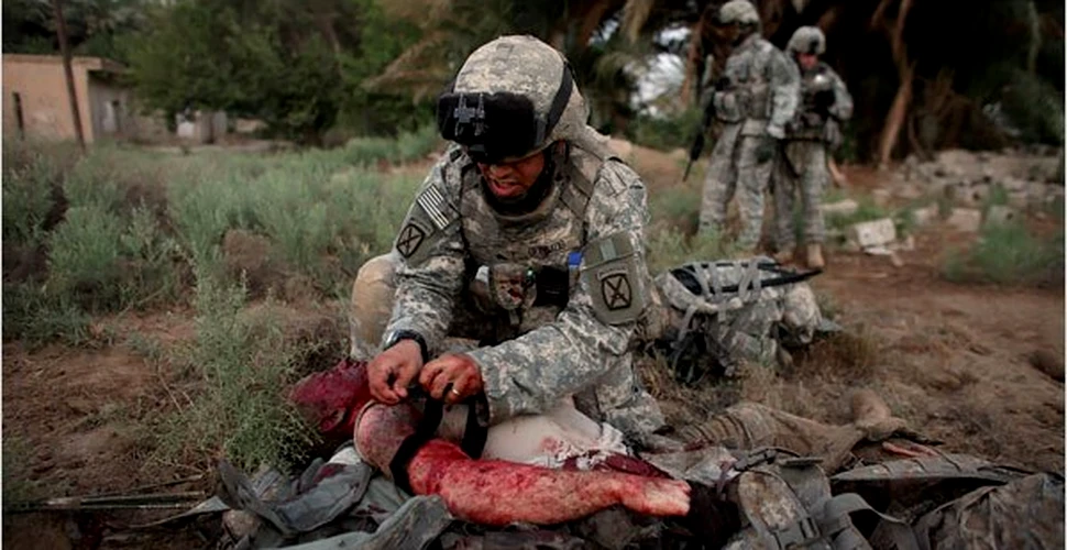Sange artificial pentru soldatii raniti
