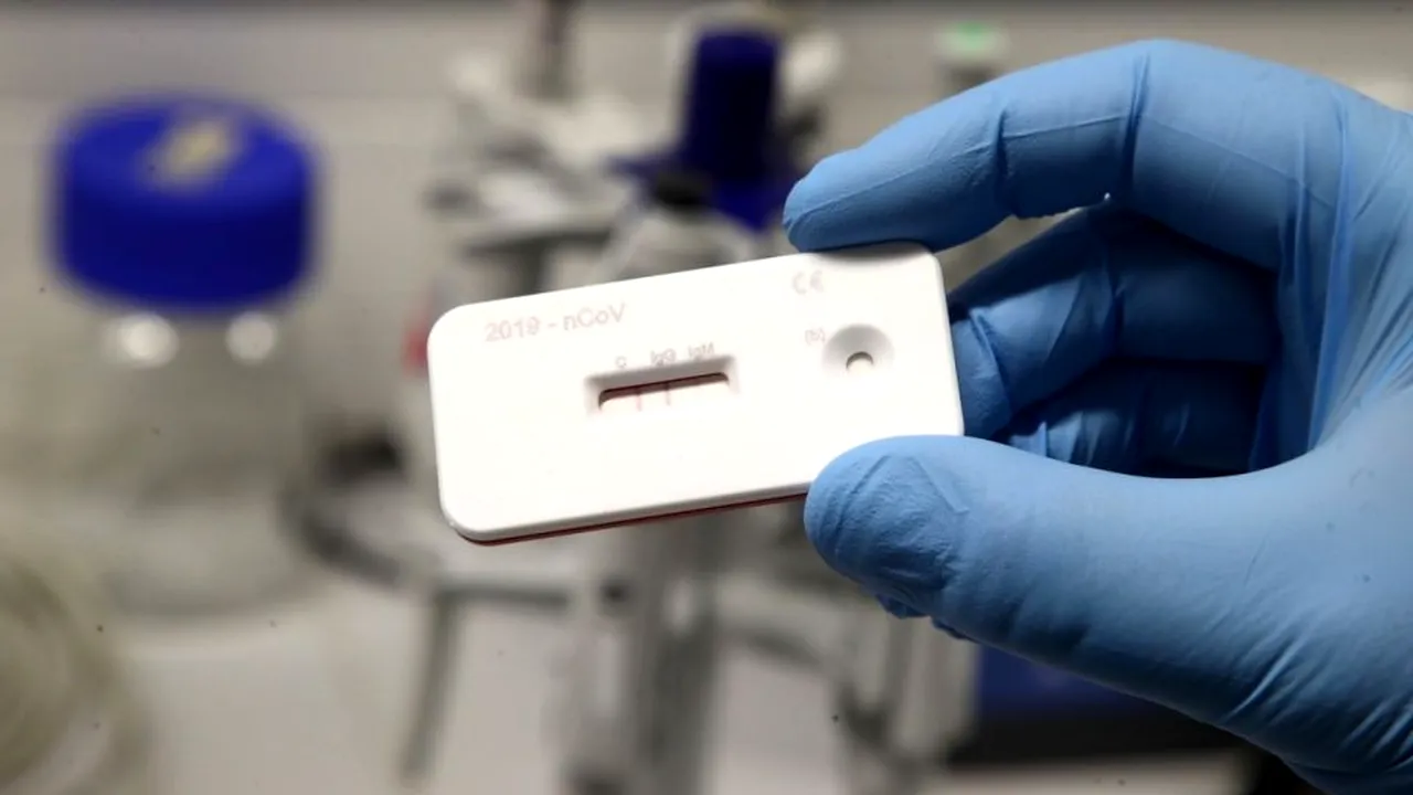 1-test-coronavirus-4-apr-2020-profimedia-0511956828-jpg-descopera 