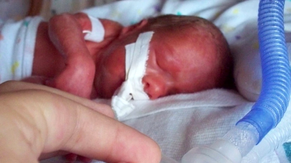 Naşterile premature vor putea fi prevenite, graţie progreselor geneticii