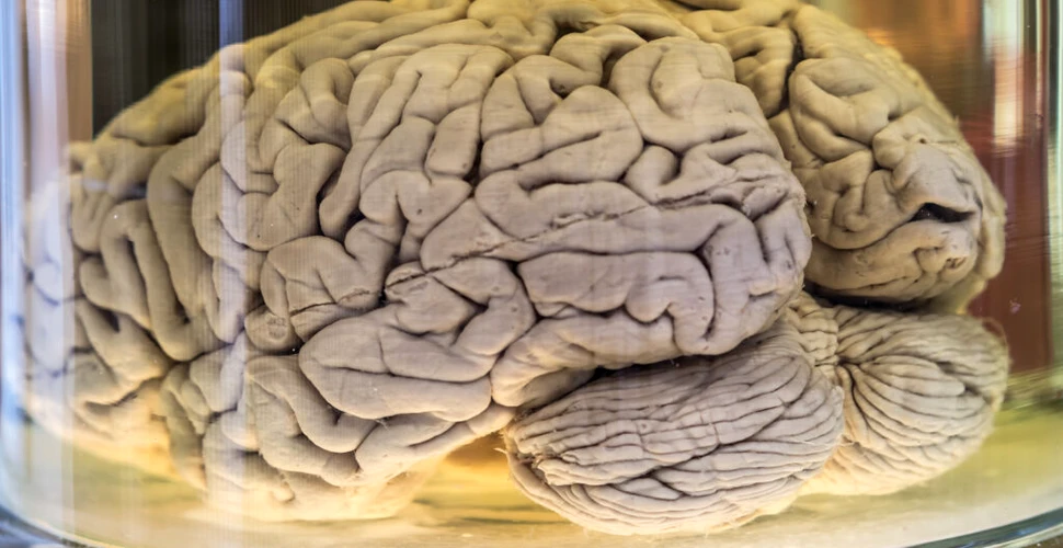 Creierul uman este atât de moale, încât se prăbușește sub propria greutate