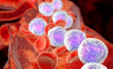 Leucemia ar putea fi vindecată cu ajutorul celulelor de laborator – studiu