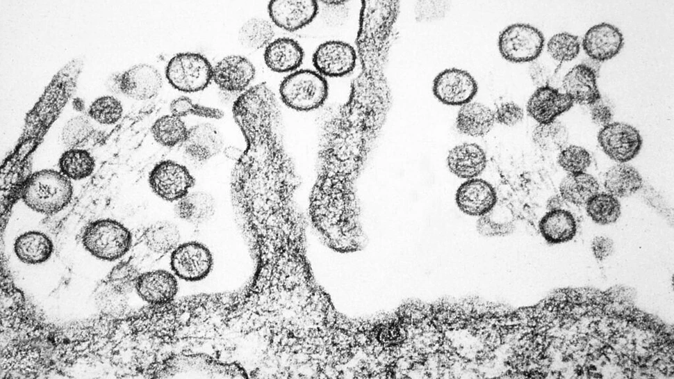 Focar mortal de hantavirus pe un vas de croazieră din Atlantic