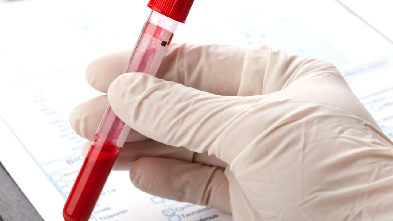 1-test-alzheimer-123rf 
