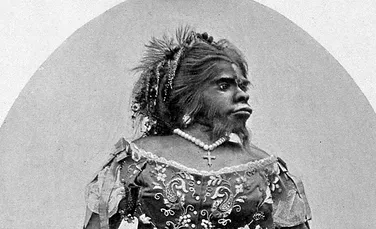 ”Femeia Maimuţă”, Julia Pastrana, ciudăţenia secolului XIX care a devenit o celebritate datorită înfăţişării sale hibride