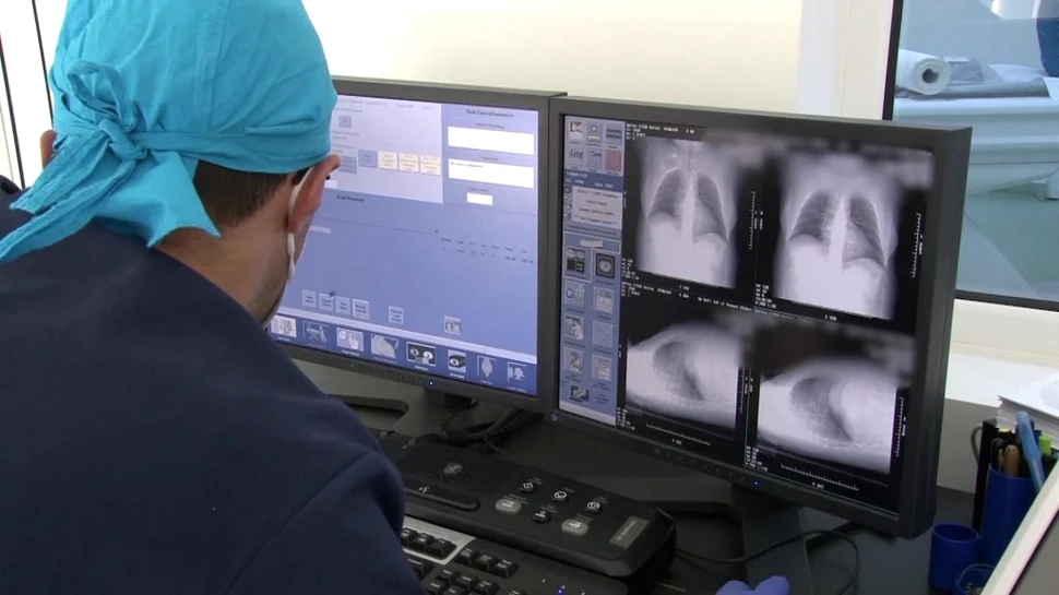 Platformă unică în țară pentru pacienții cu boli pulmonare, lansată la Timișoara