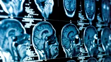 Cercetătorii au identificat regiunea din creier implicată în controlul atenției