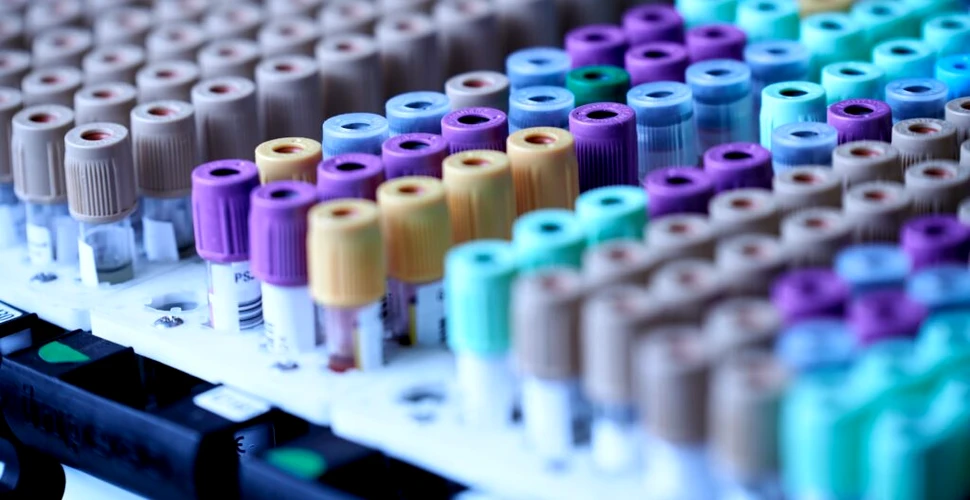 Testul de sânge cu Inteligență Artificială poate detecta cancerul hepatic