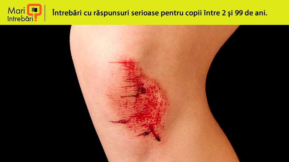De ce ne doare când ne lovim sau ne zgâriem?