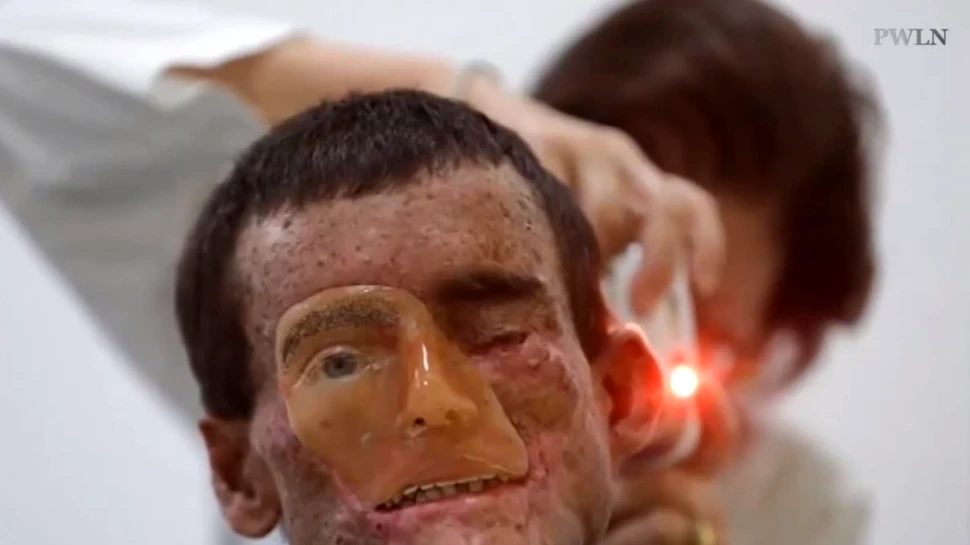 Boala cumplită care mutilează pe viaţă 1 din 40 de locuitori. Ce se întâmplă în acest sat izolat? (VIDEO)