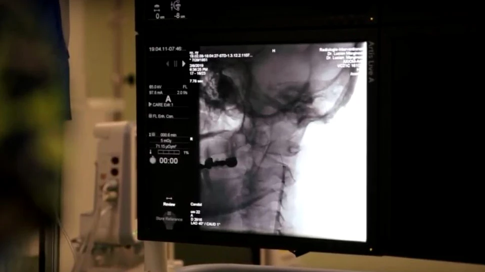 Nou centru de excelenţă pentru tratarea AVC-ului, la Târgu Mureş. Diagnosticul se pune în două minute – VIDEO