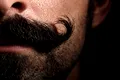 Transplantul de barbă: Între modă și capcană costisitoare