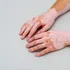 Un medicament pentru persoanele cu vitiligo a avut rezultate promițătoare într-un studiu clinic