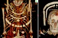 Arheologii au reușit, în sfârșit, să vadă ce ascund la interior mai multe mumii descoperite în 1615