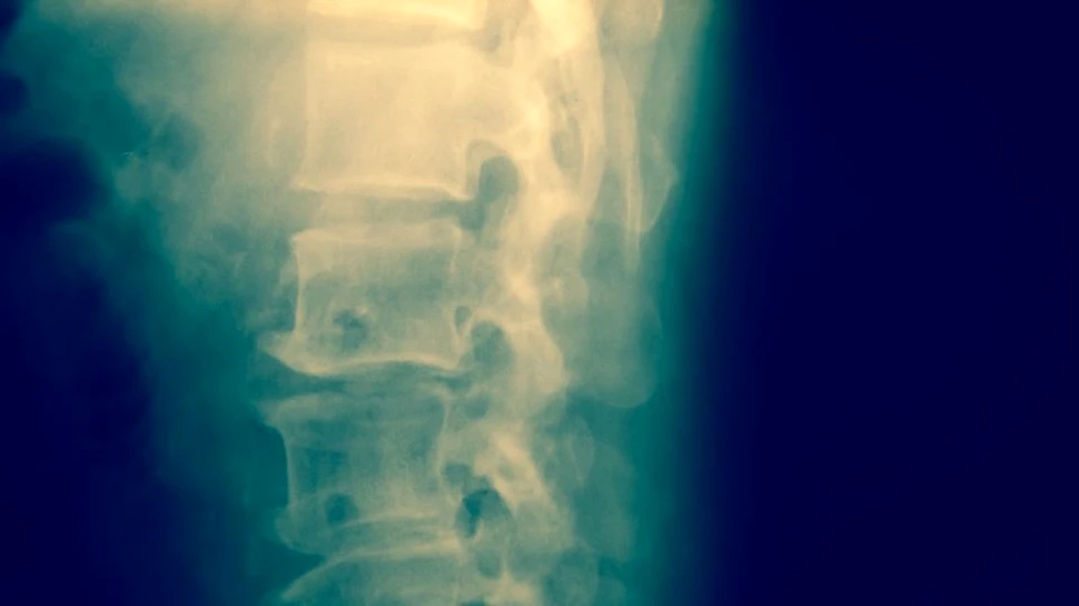 Coloana vertebrală este mai ”inteligentă” decât se credea anterior