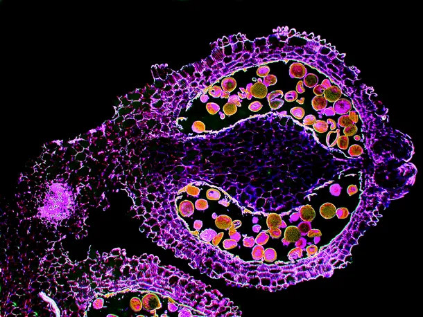 Celulele diferitor organisme privite sub microscop şi microfotografiile uimitoare ale acestora. 