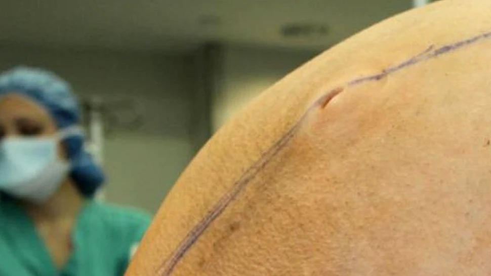 Ţara care îşi cere iertare pentru că a sterilizat cu forţa populaţia