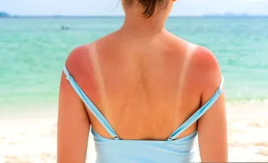 Pielea noastră are o armă secretă împotriva cancerului, însă Soarele o dezactivează