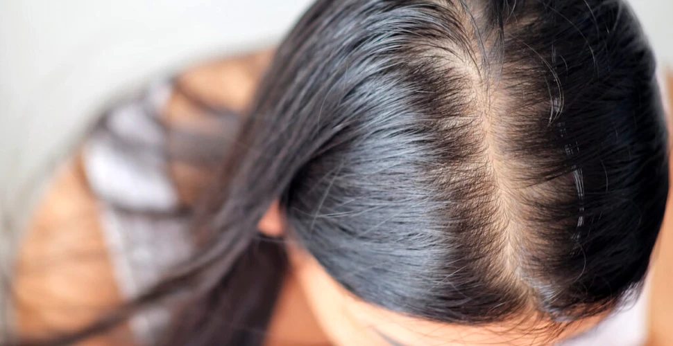 Un medicament care ar putea trata pierderea părului, tot mai aproape de realitate