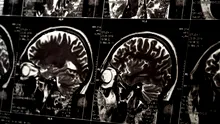 Au fost indentificate zonele din creier care ne ajută să ne amintim cuvinte