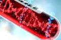 Legături genetice descoperite între rezultatele la testele de sânge și unele boli mintale