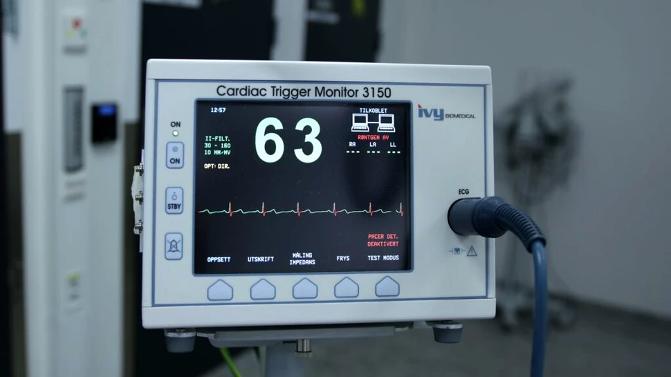 Au fost descoperiți noi factori genetici ai aritmiei